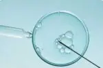 In Vitro Fertilization (IVF) - Image 4