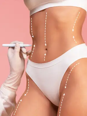 Liposuction